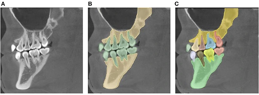 GPU use in Medical Imaging